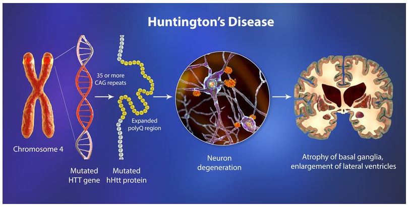 Micro RNA Technique Fighting Huntington Disease