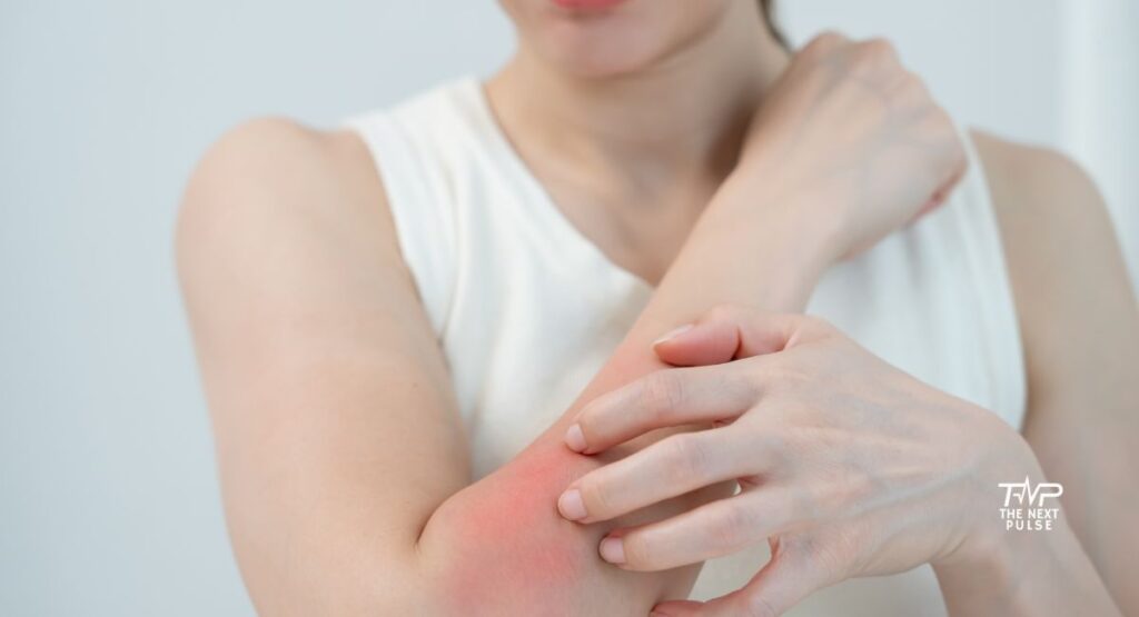 Itchy and Rash Prone Skin 5