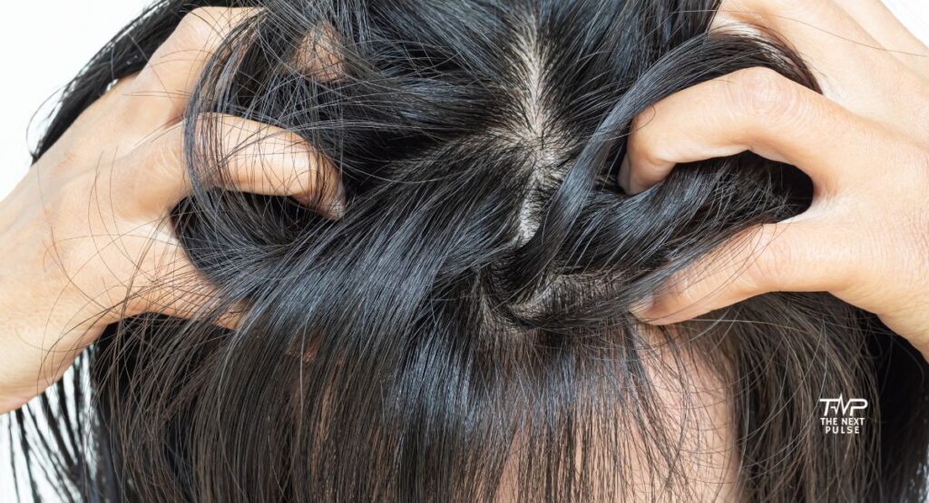 Treat Itchy Scalp Naturally