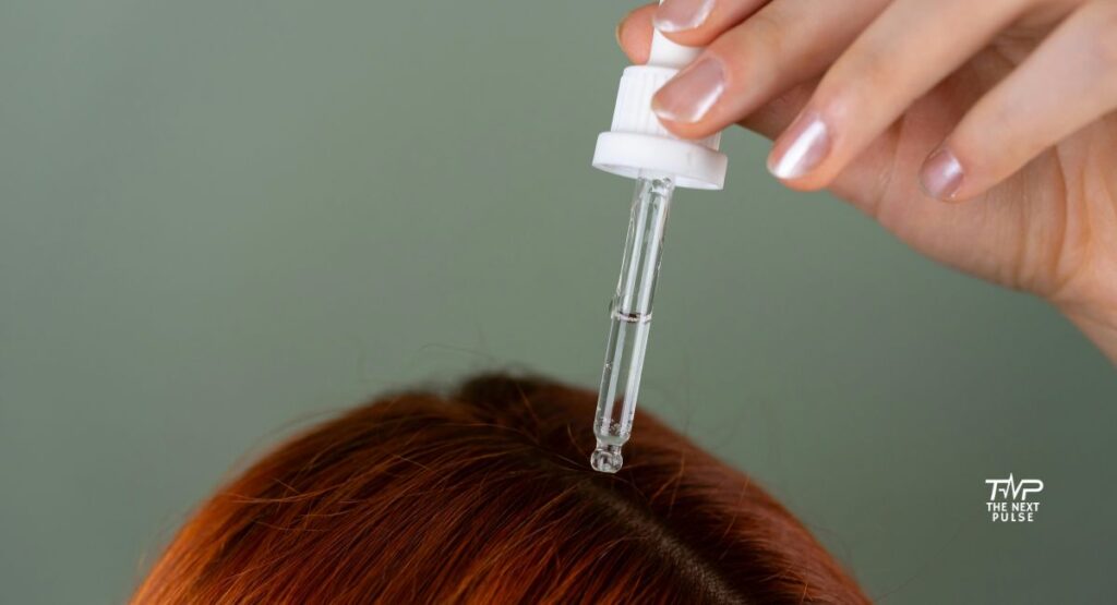 Treat Itchy Scalp Naturally