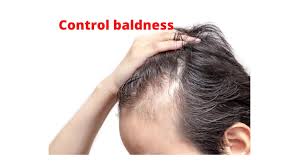 Advanced Hair Loss Prevention